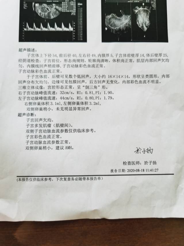 胎停两次未胚染目前检查中amh148ng/m