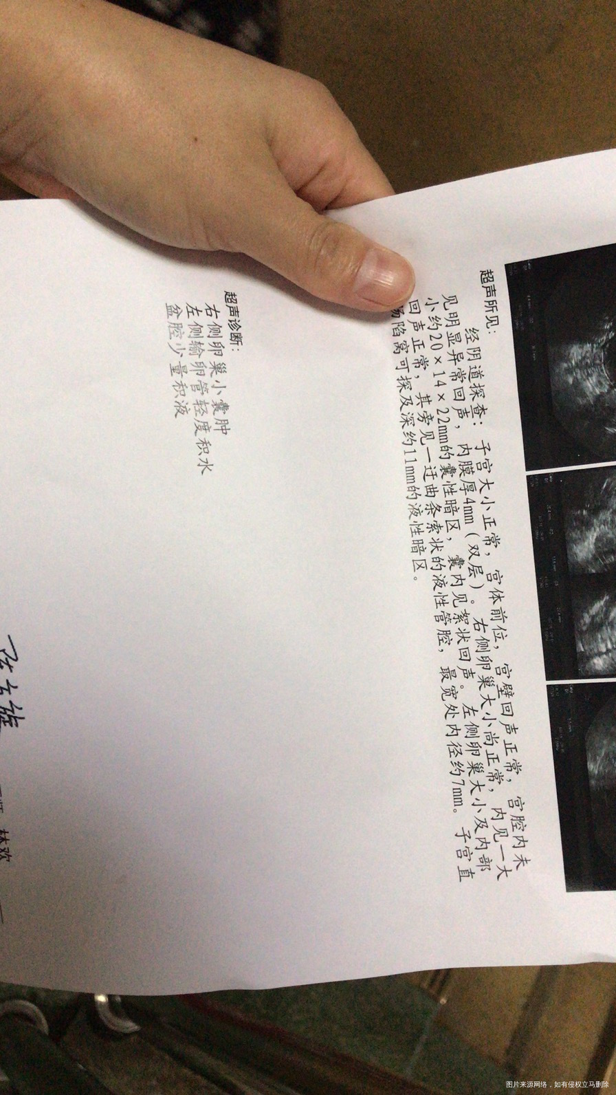 月经第15打的B超内膜5mm第20天打的B超