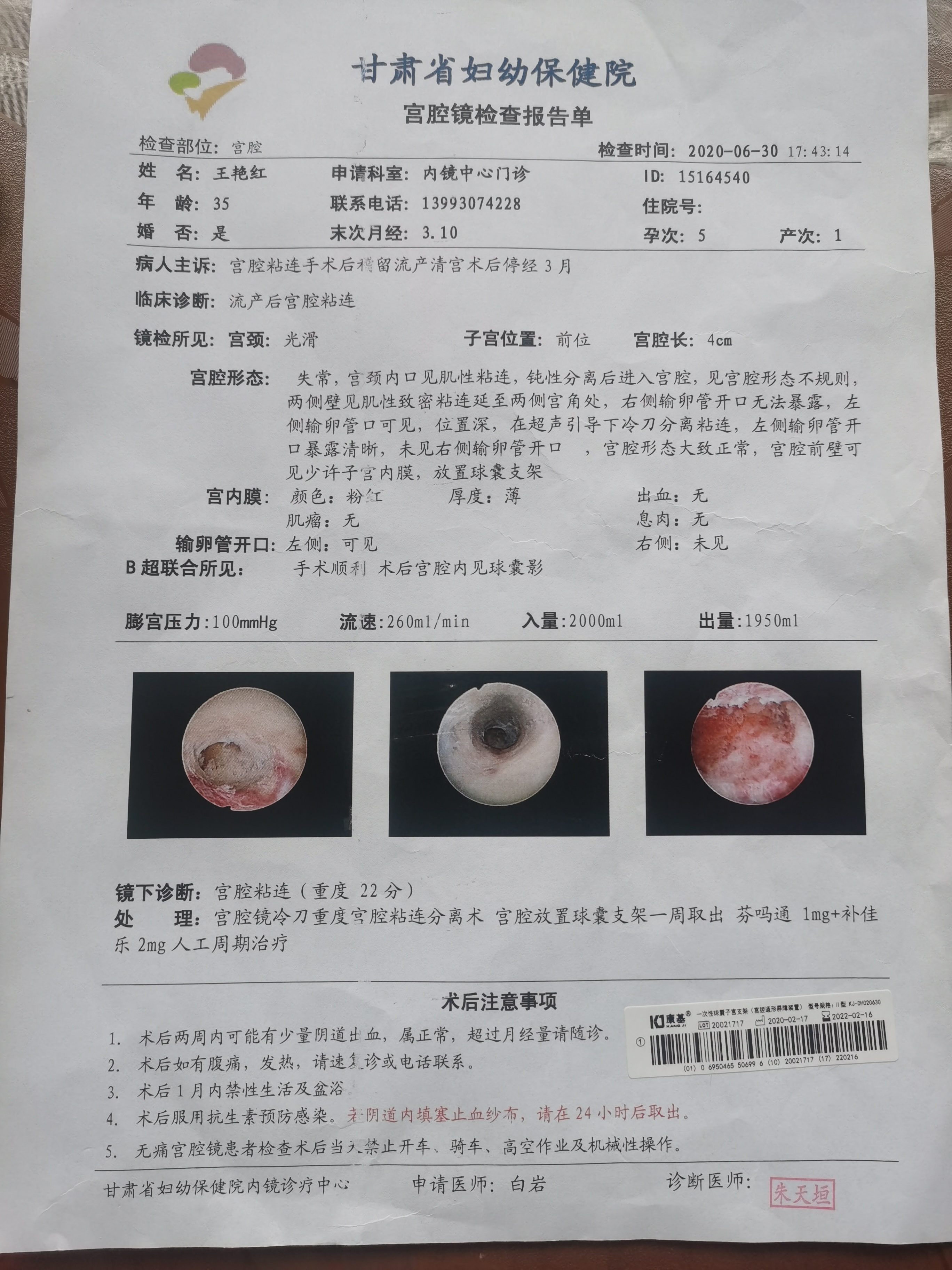 因为中期引产做过三次宫腔粘连分离手术后来怀孕