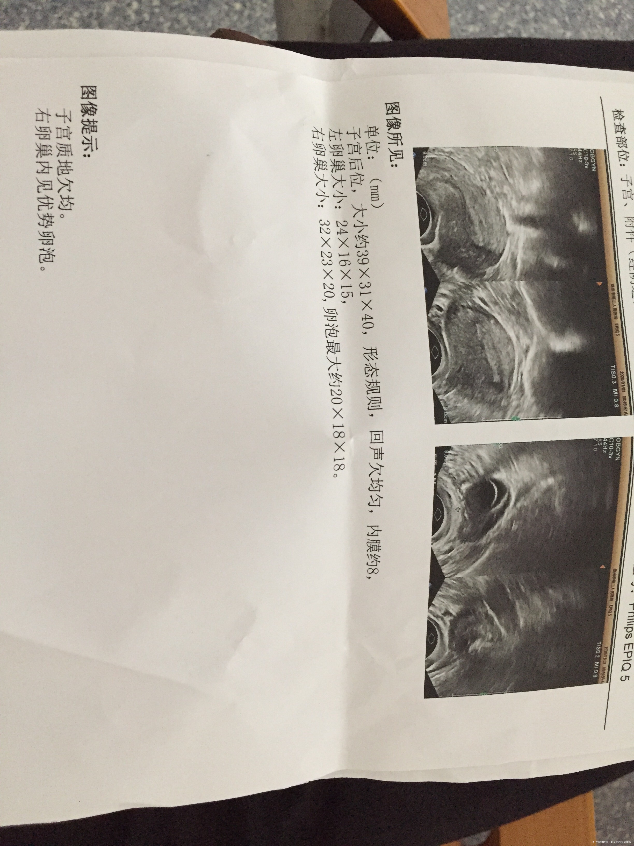 月经不调时前时后这两个月都是45天来一次月经