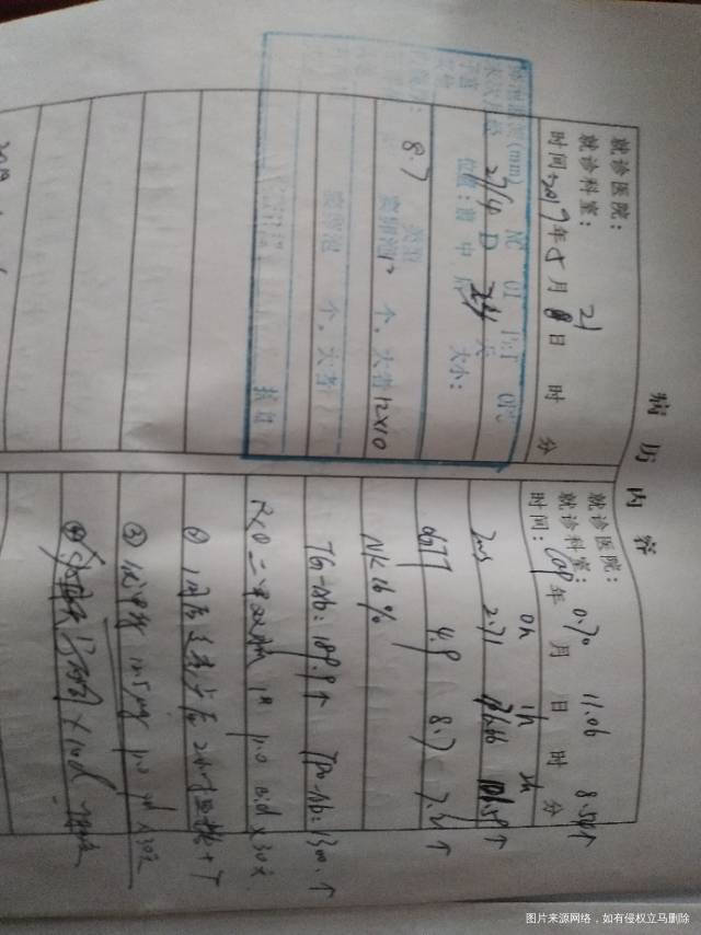 染色体检查合格19年检查医生说是多囊卵巢胰岛