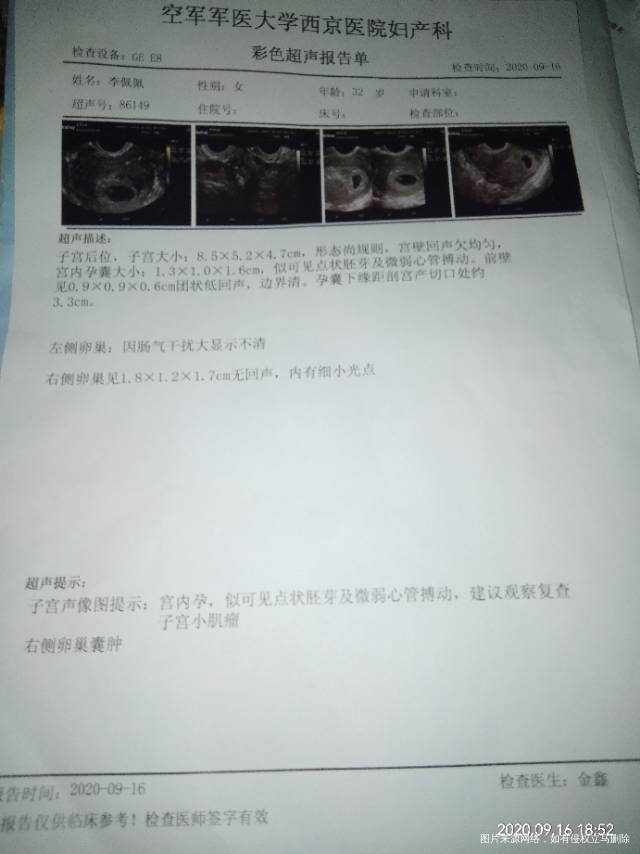 现在六周4天可是孕铜低现在有什么办法把孕铜补