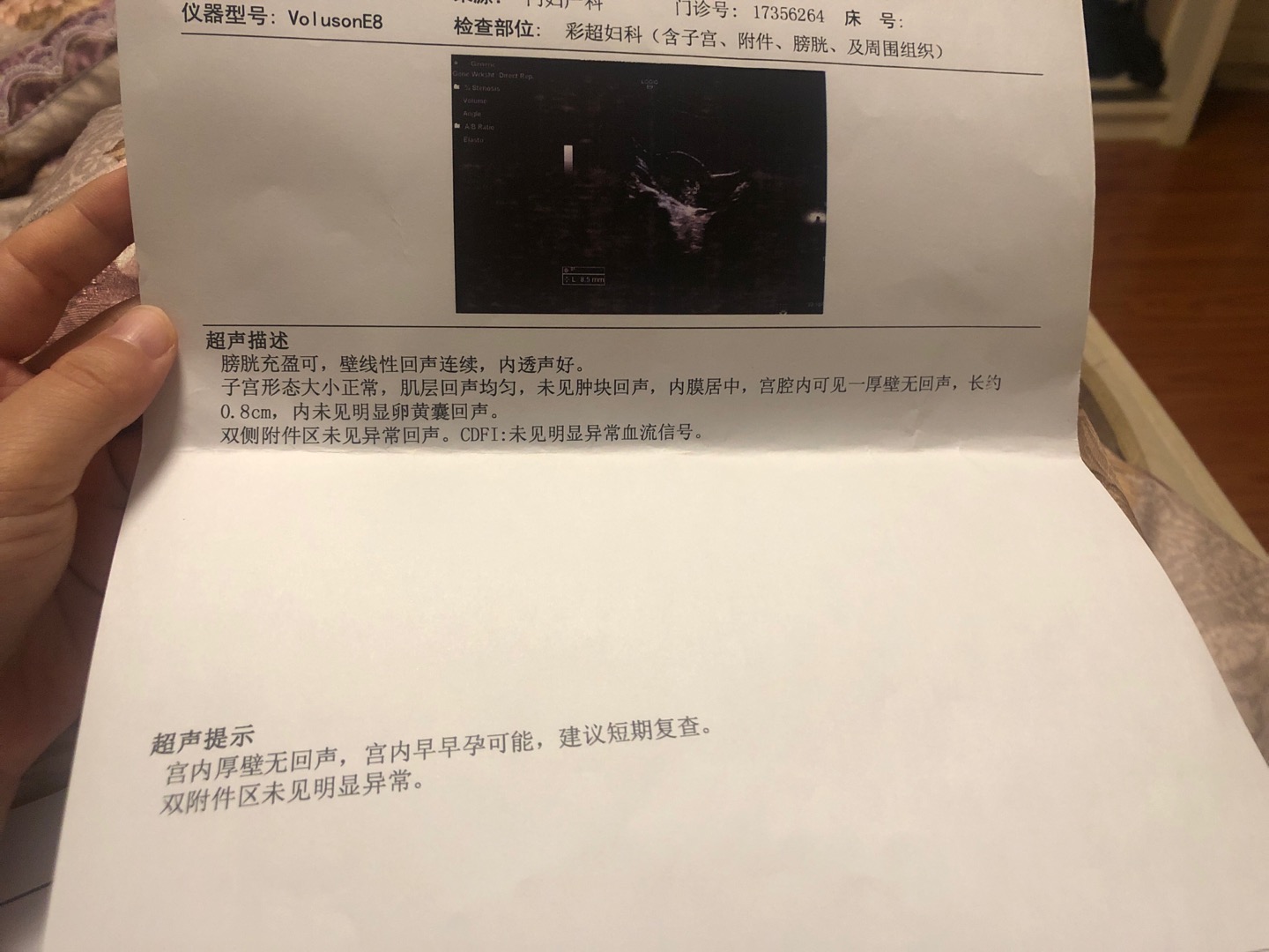 月经不规律末次月经是7月8的是吃药来的甲状腺