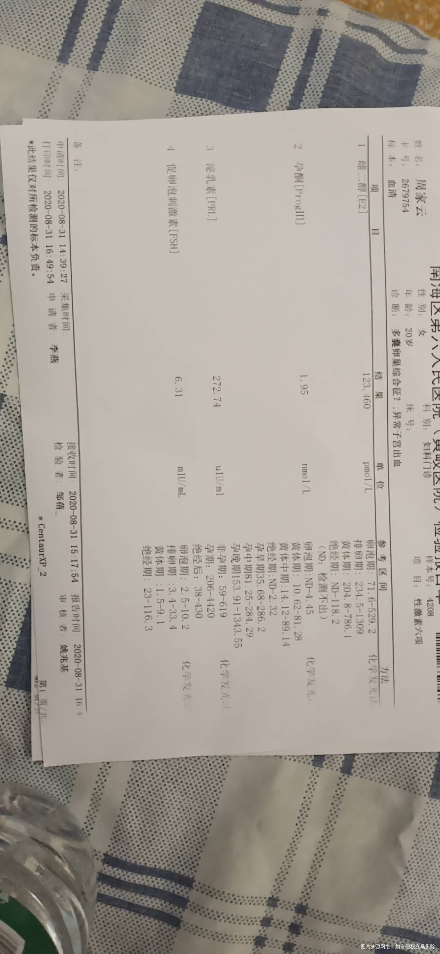 有没有帮忙看看正常吗