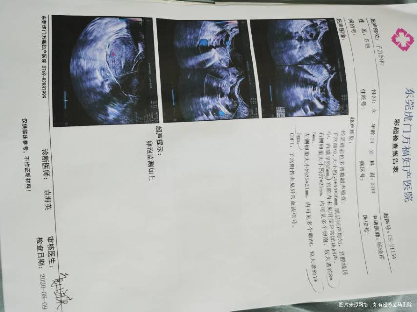 多囊卵巢脸上有痤疮想备孕