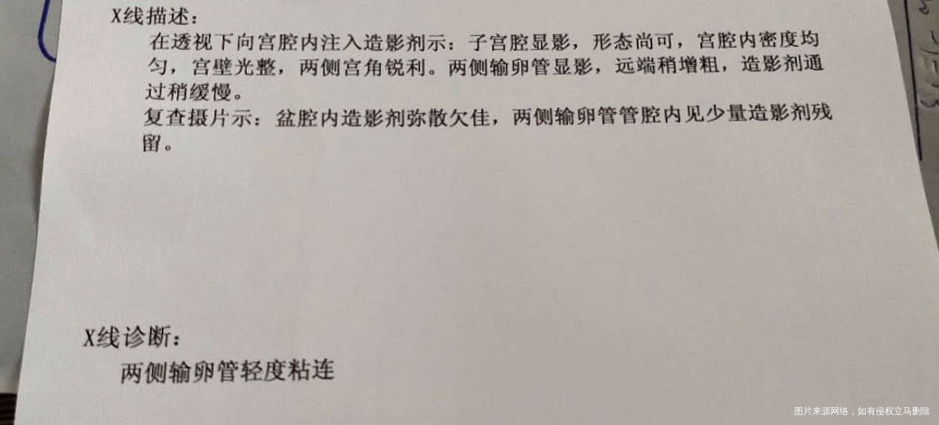 医生您好1AMH1247ng/ml孕酮未测其