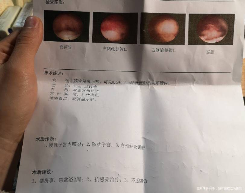 月经量很少一两天就结束怀疑粘连图为宫腔镜手术