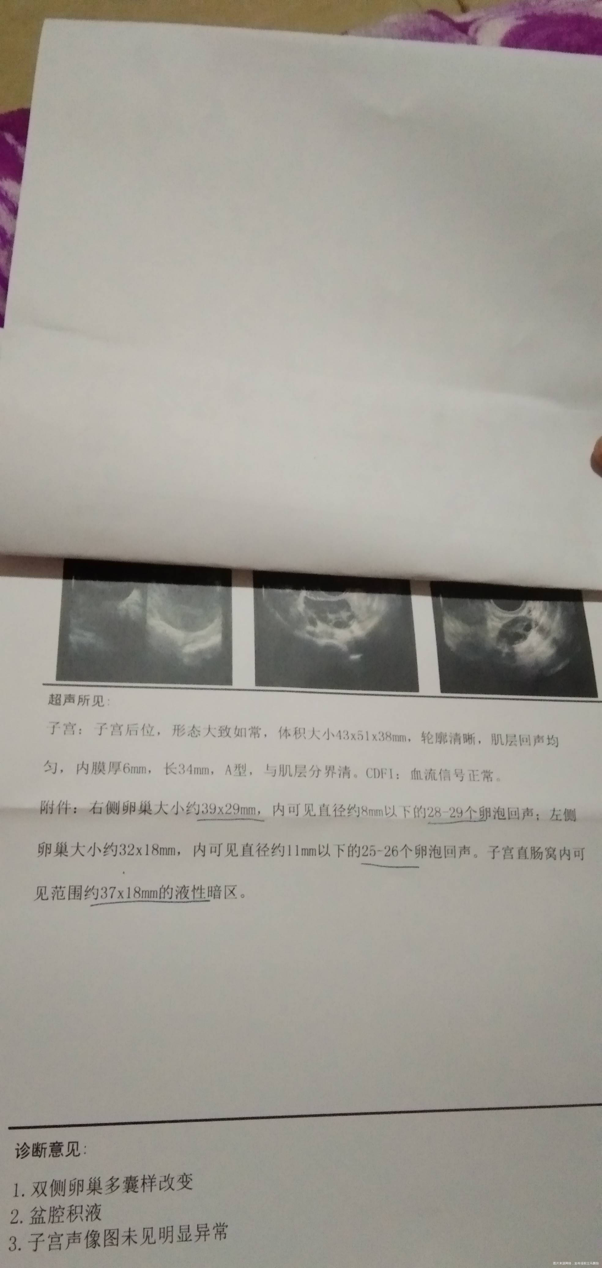 医院检查报告出来了这个病症的关键是不是在输卵