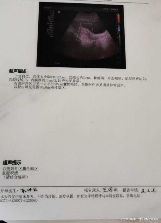 8月2号来的月经8月12号做的输卵管造影结果