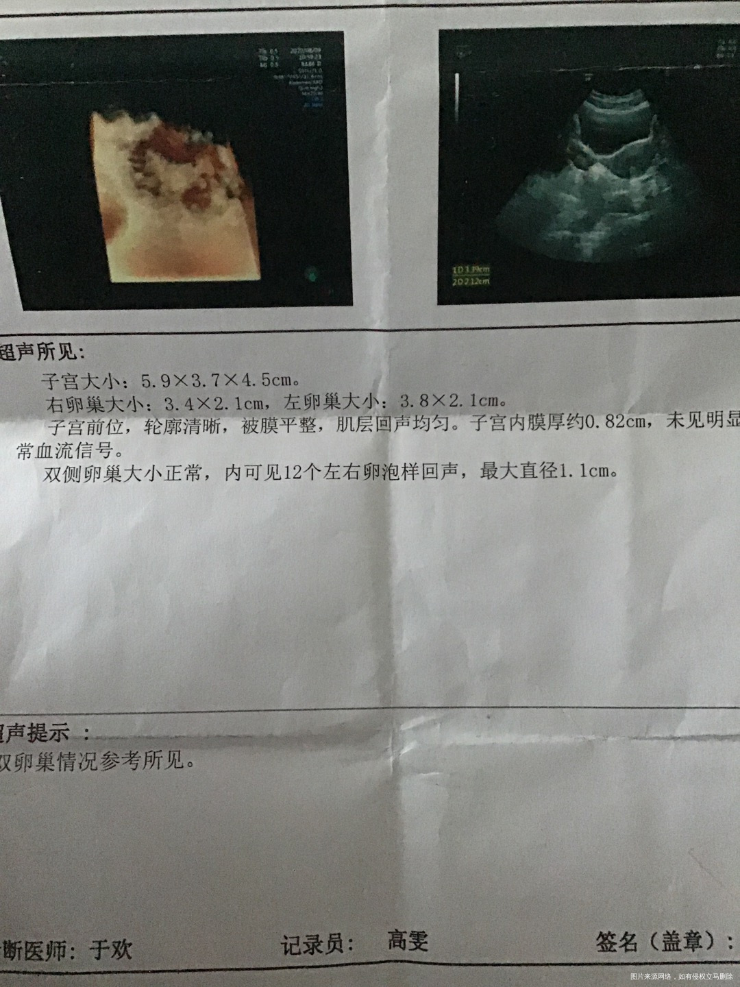 喝了4个月中药这个经期第三天检查报告暂时不准