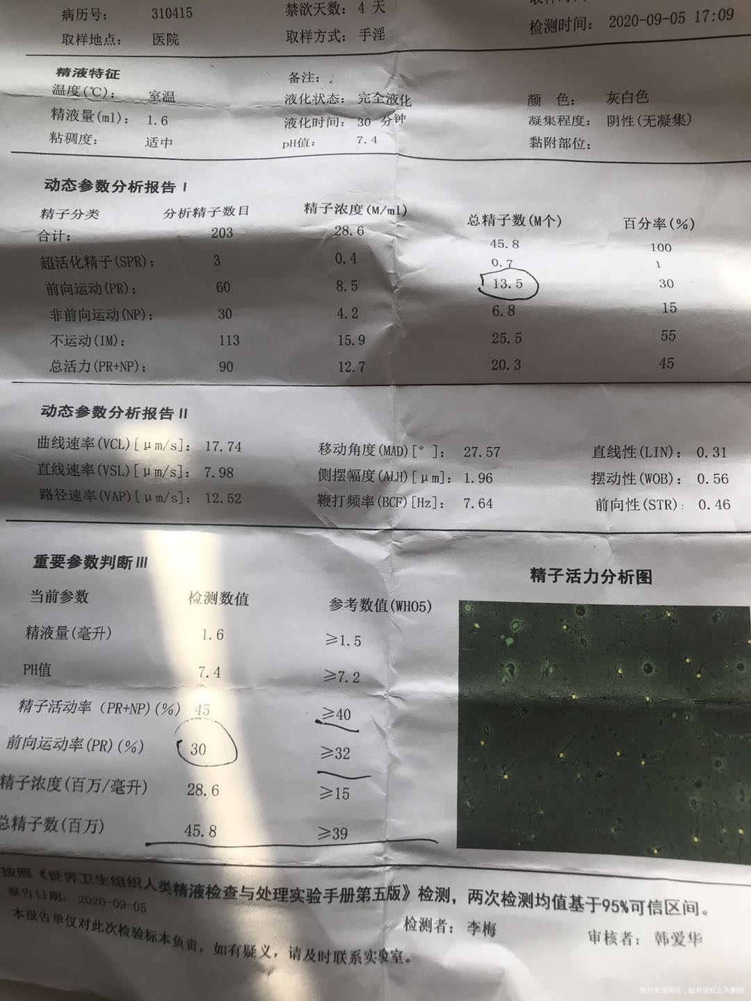 精子畸形率98需要做人授吗正常怀孕几率大吗