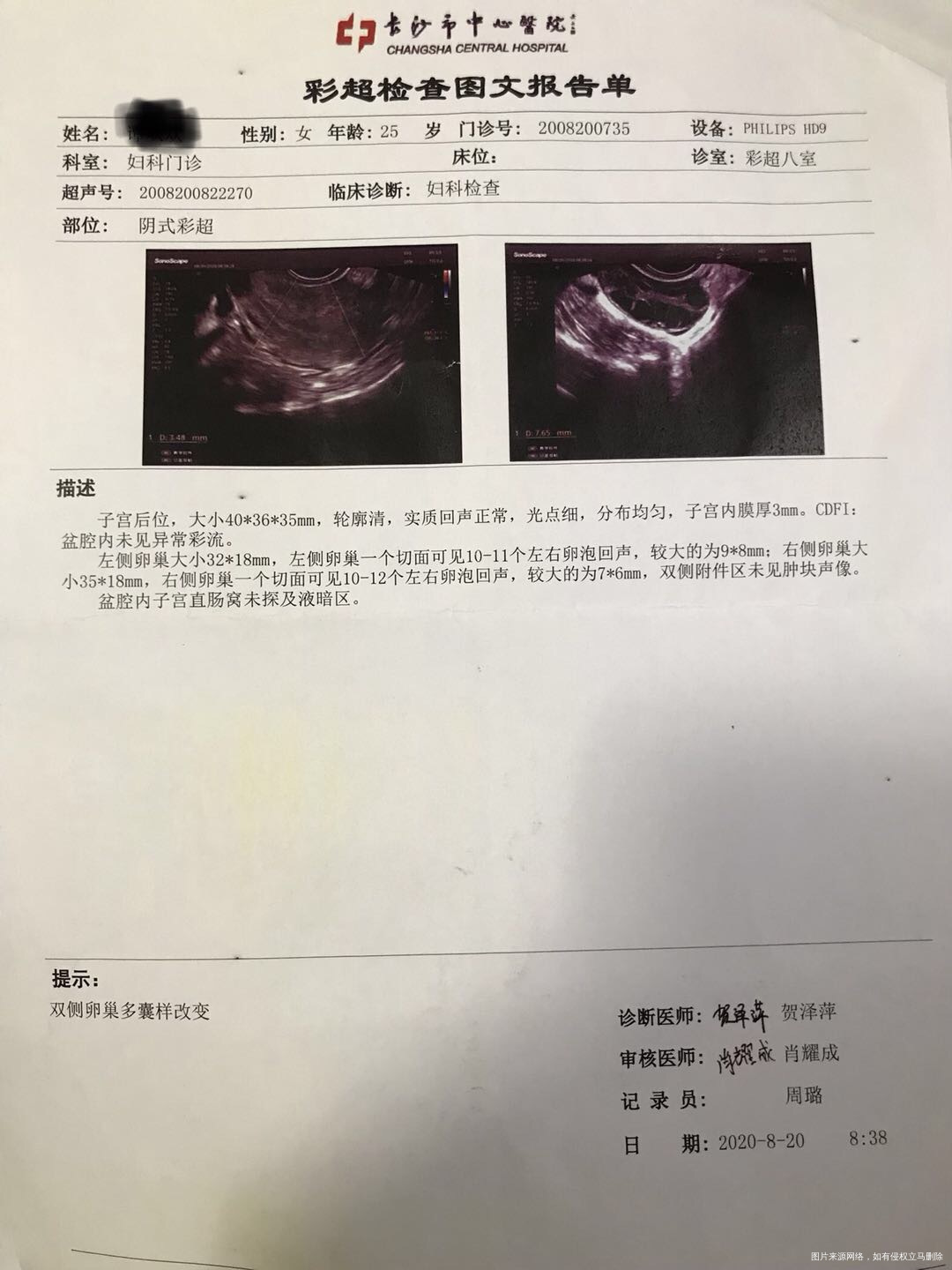 来月经量比以前要少颜色偏黑来的多的时候才能看