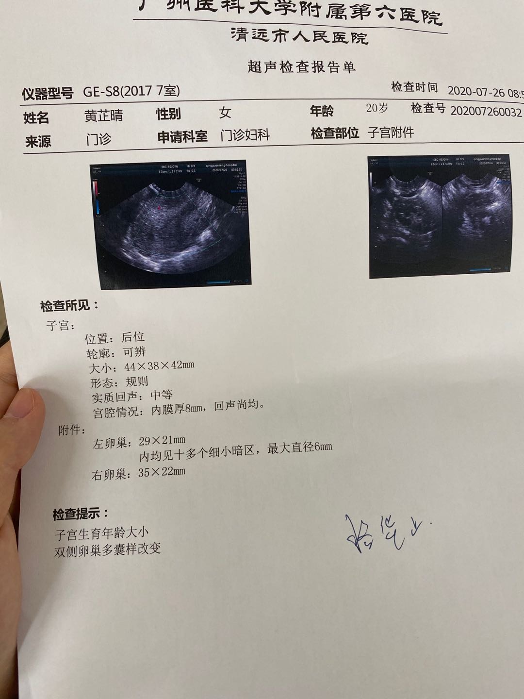 你好请问一下我性激素检查结果都是正常但b超结