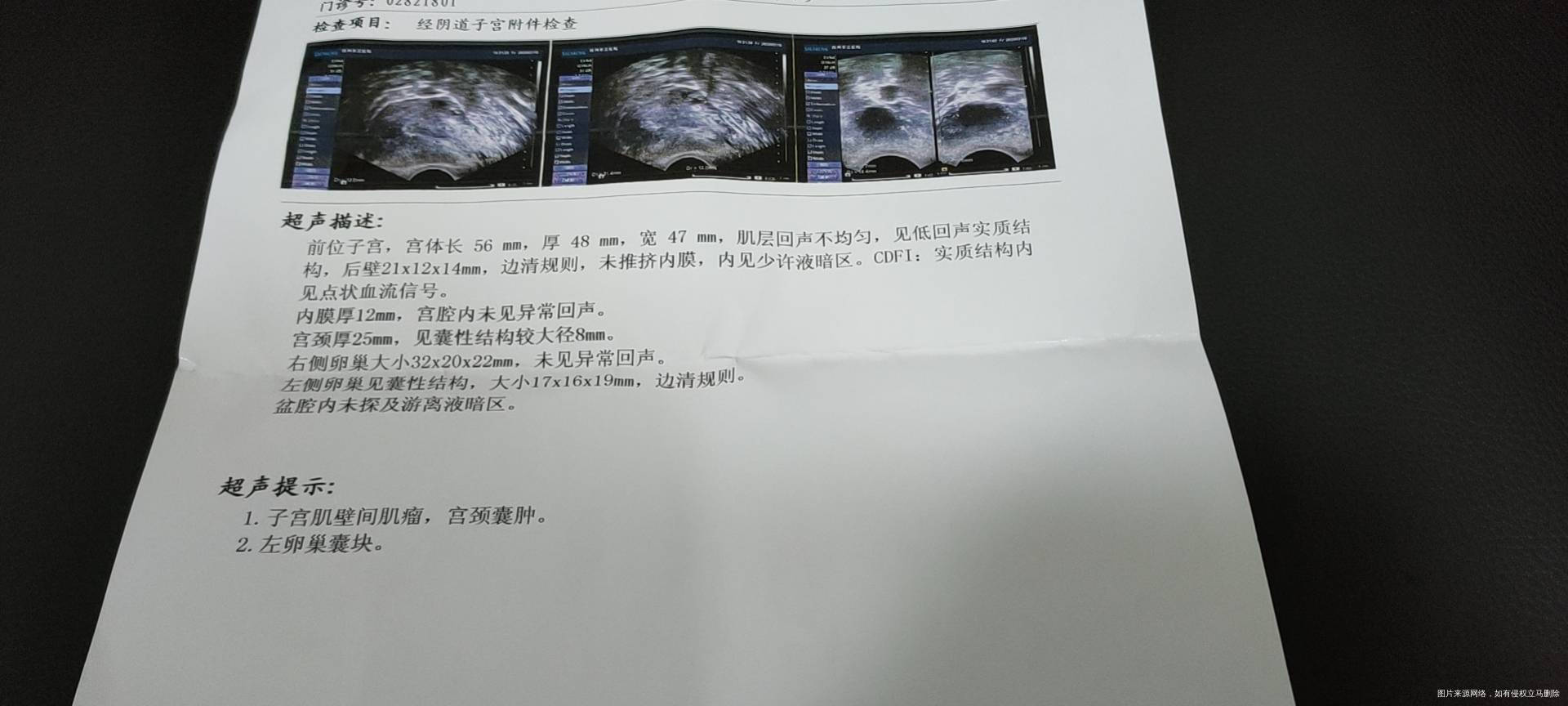 月经不调淋漓不尽怎么办