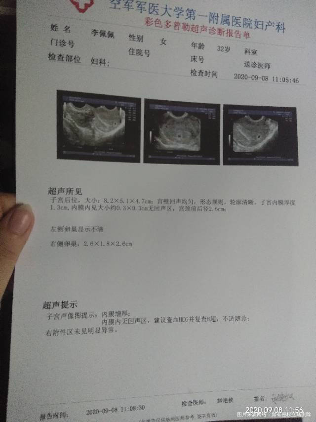医生麻烦看看是宫内好吧今天检查是大姨妈超的第