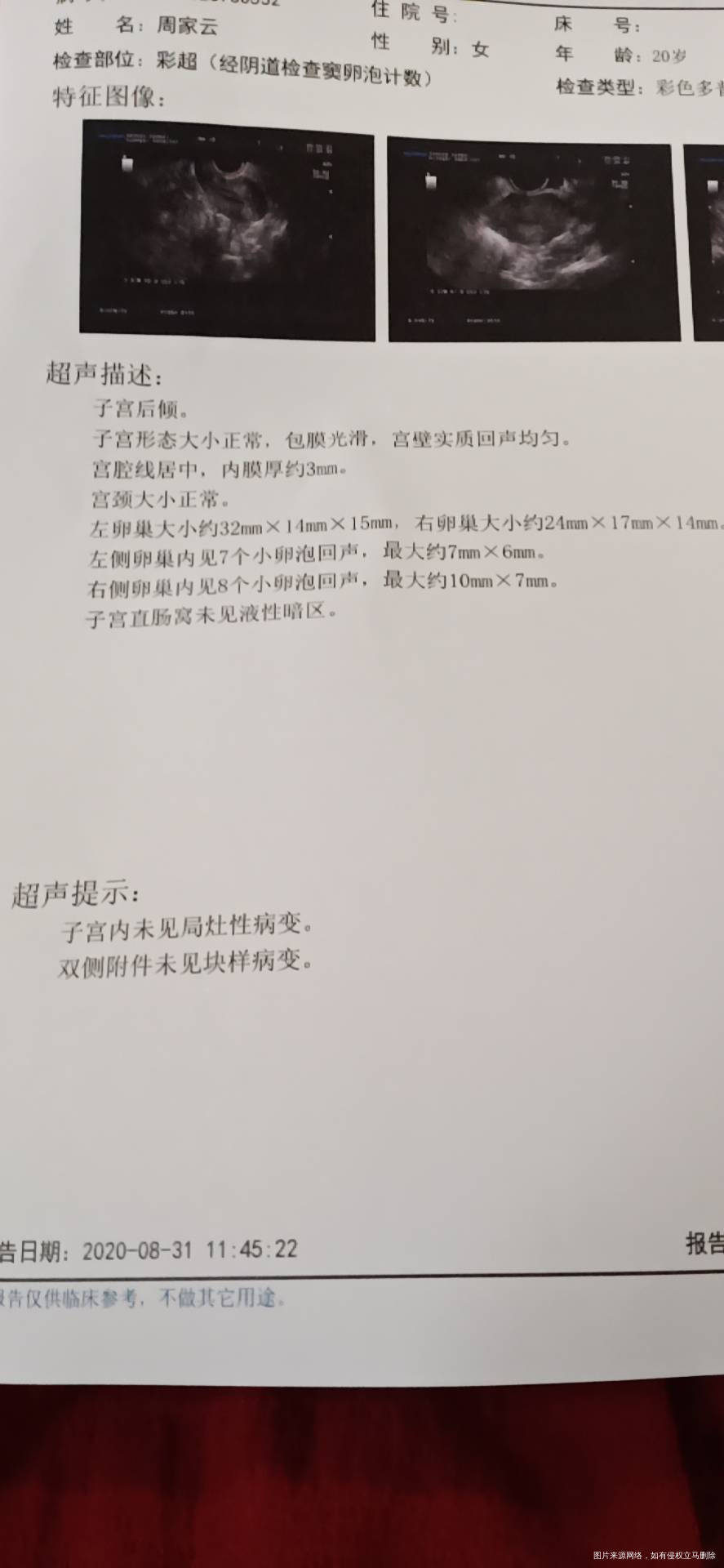 有没有帮忙看看正常吗