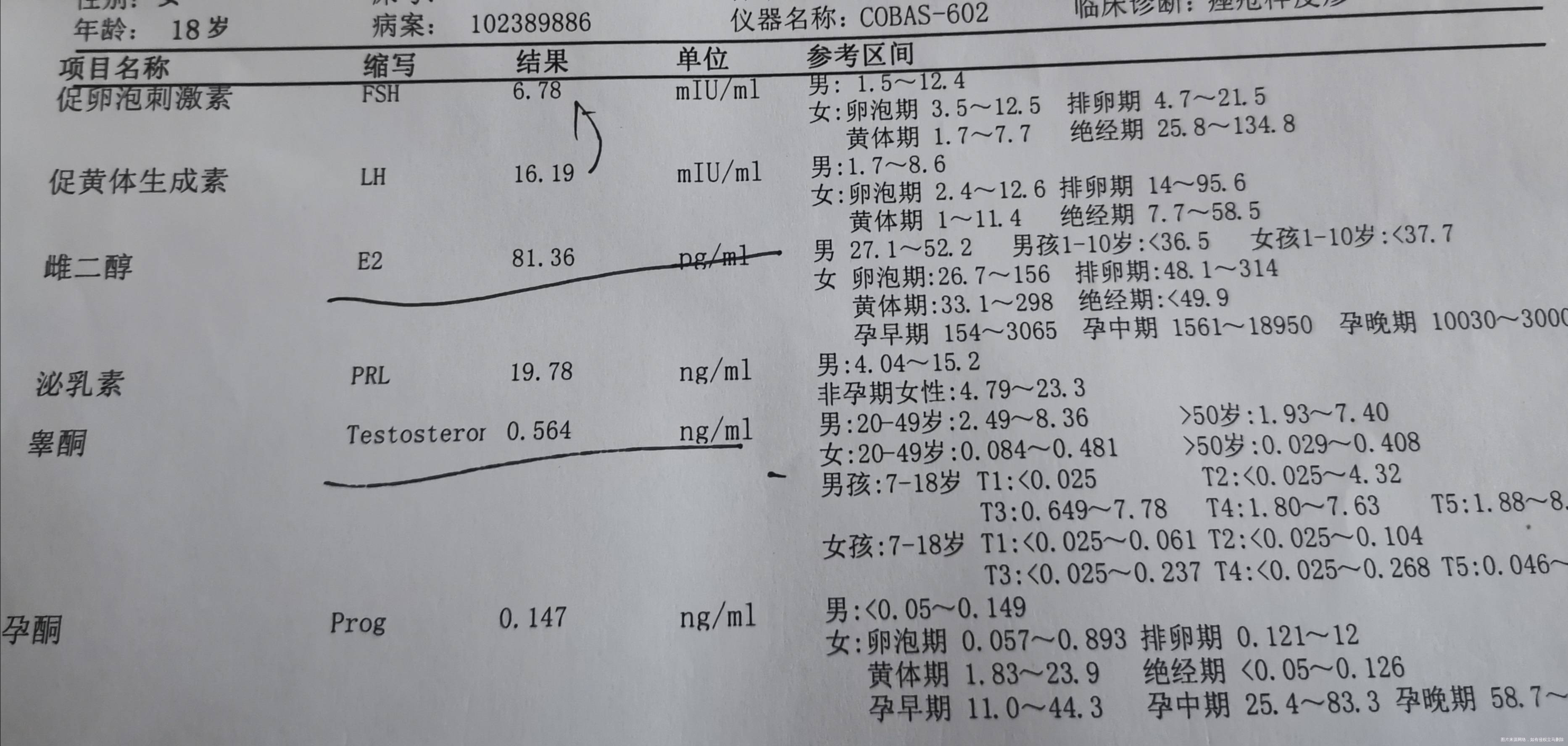 18岁多囊综合征无怀孕要求开了达因35医生说