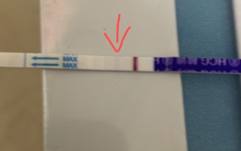 试管囊胚移植第几天可以测出来我打得绒促现在测