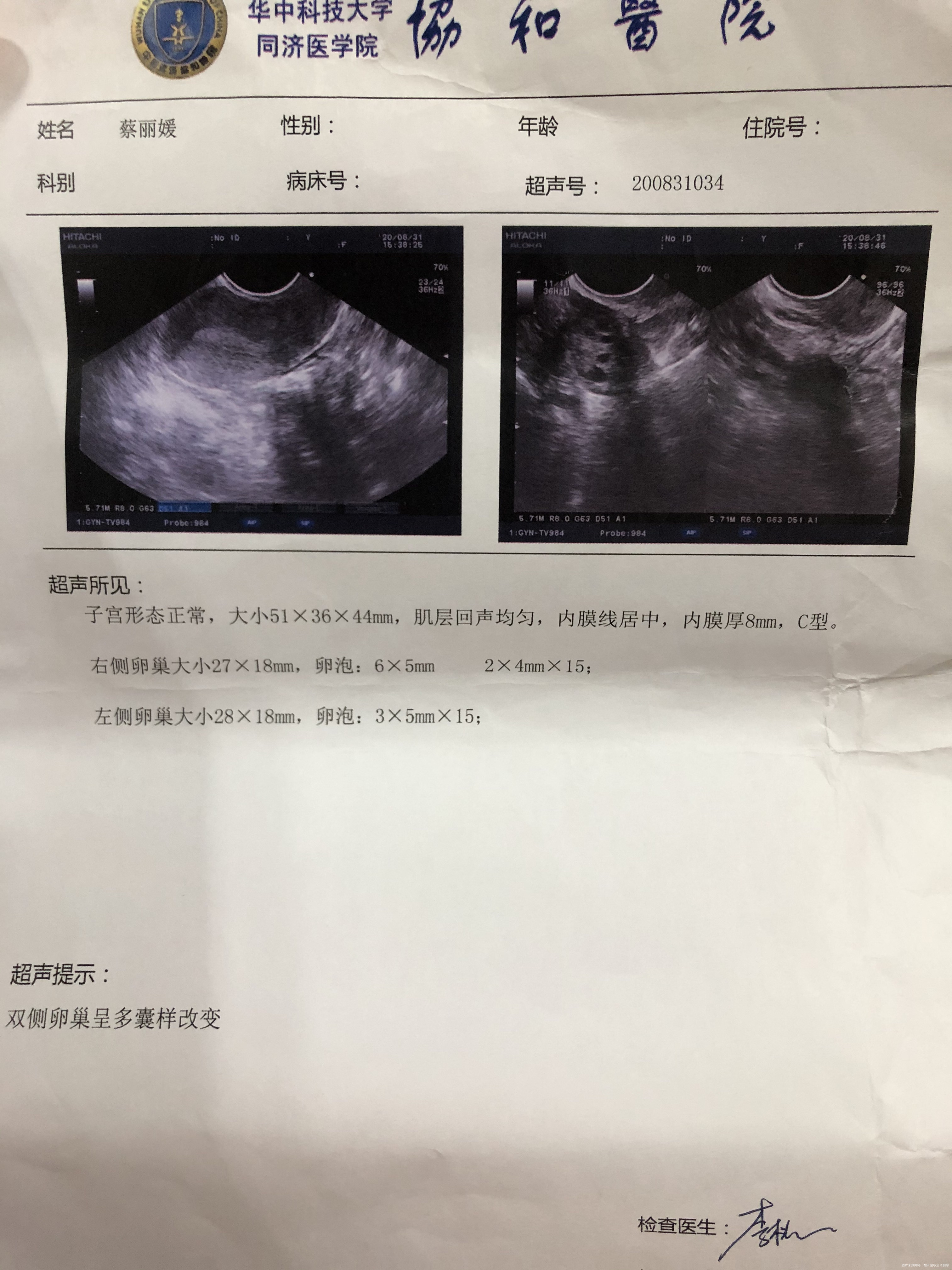 上个月检查还说雄激素高阴道B超没有异常今天来