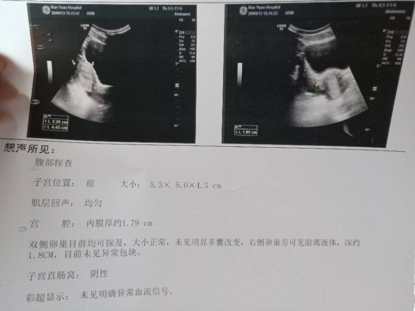 730末次月经月经周期38天左右911护垫量