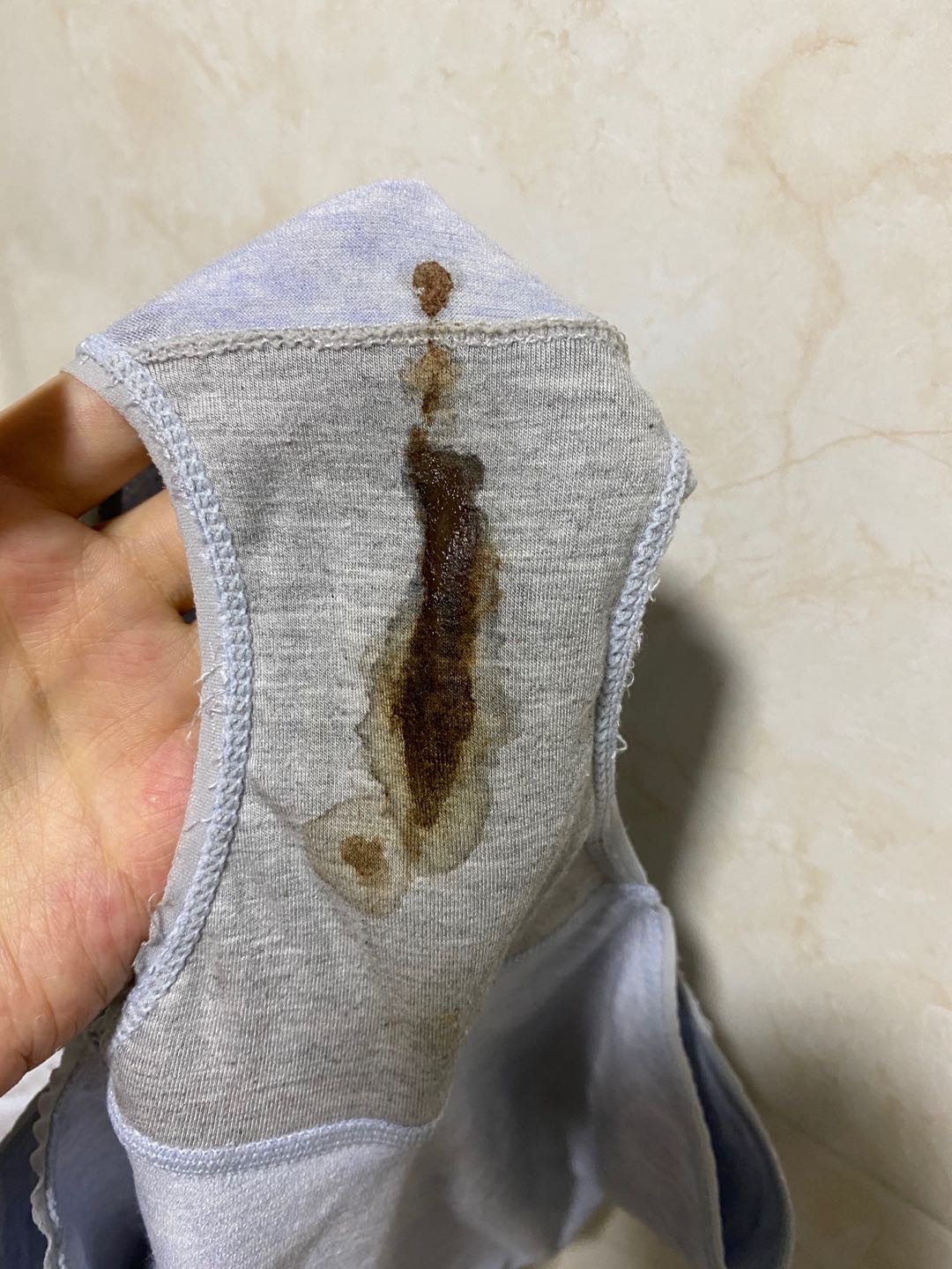 医生你好我在正常周期排卵期流了5天褐色分泌物