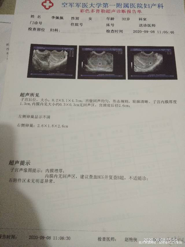 检查都出来了确定怀孕了可是感觉肚子抽的不舒服