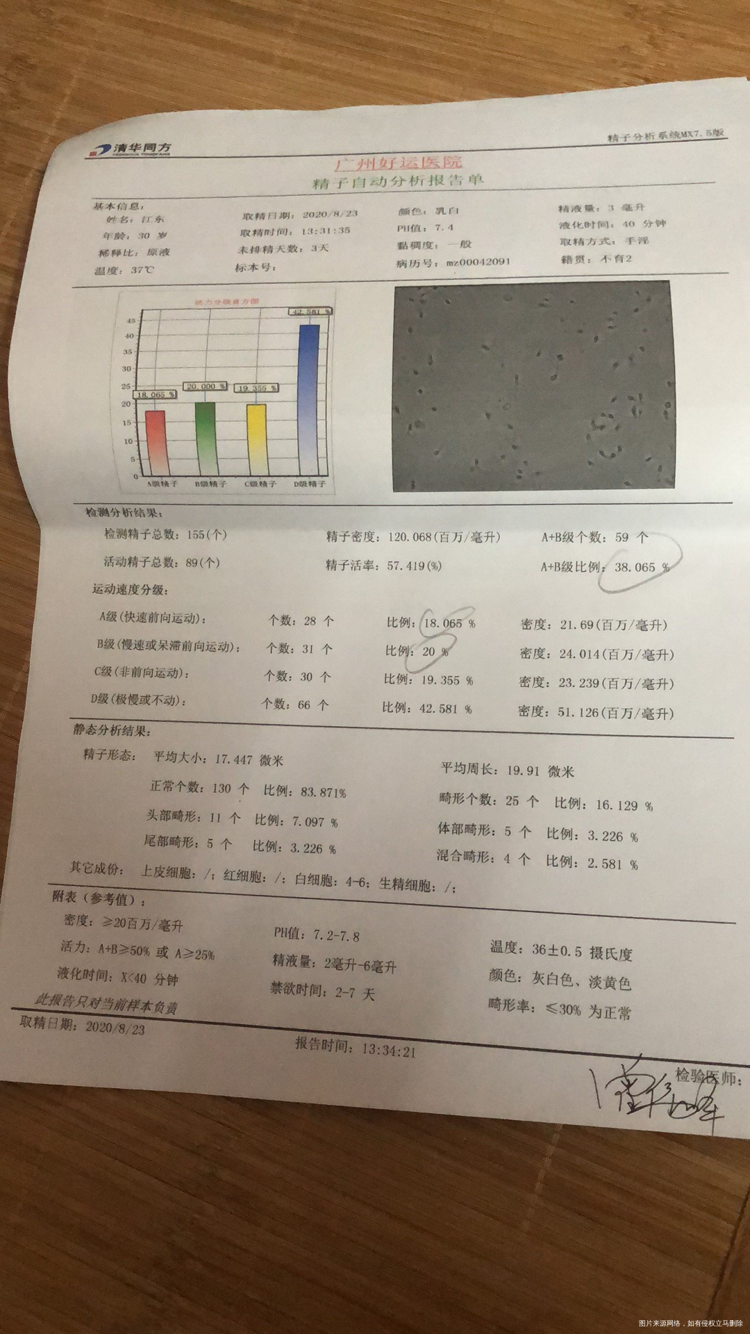 帮忙看看我的卵泡20×14质量好不好
