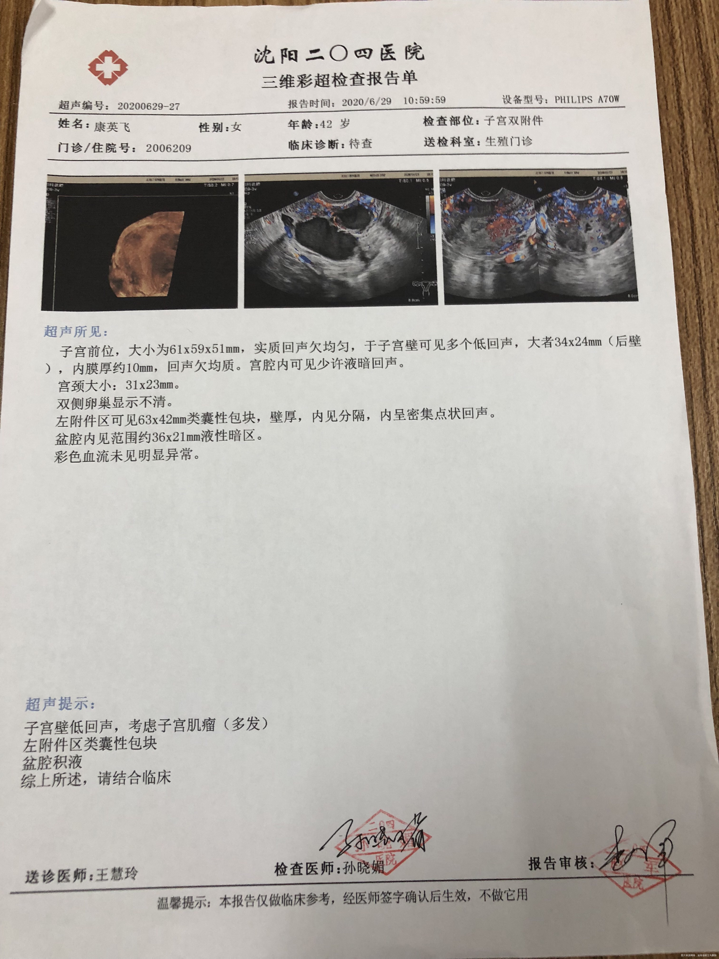 我做过两次手术现在有巧克力囊肿还有点卵巢早衰