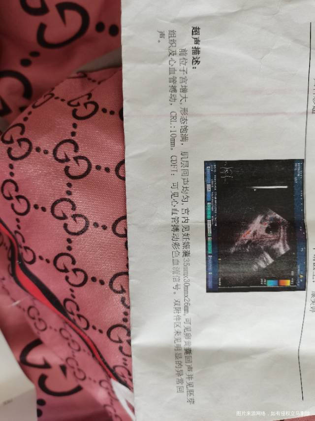 为什么b超检查和抽血都正常还会留褐色分泌物