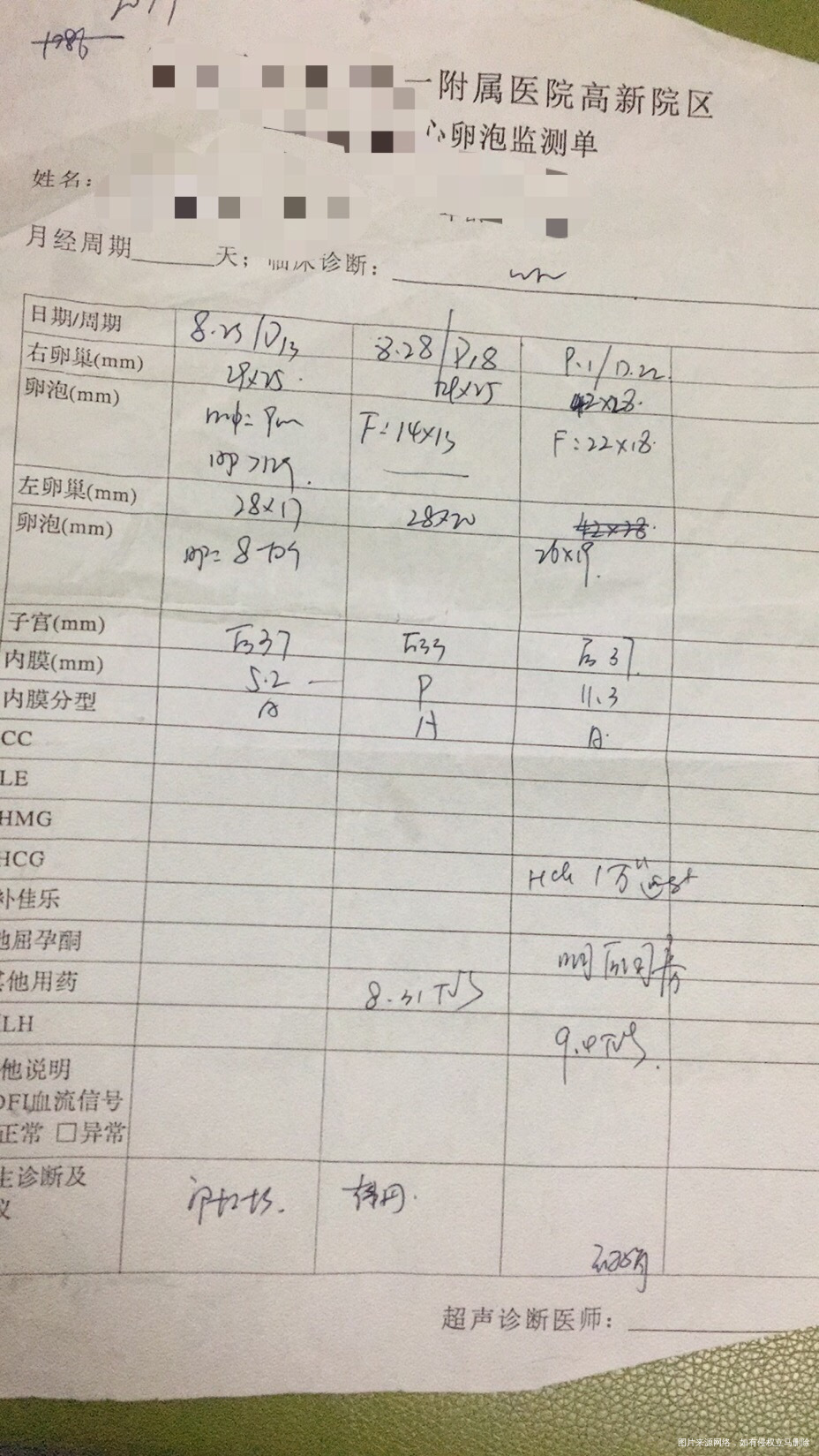 监排的促排怀孕可能性大吗如没怀上后面还需要做