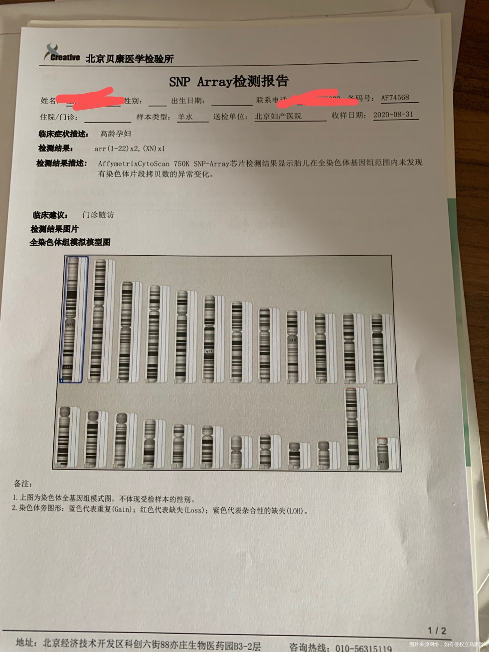 今年4月25日移植两个鲜胚二级一个三级一个两