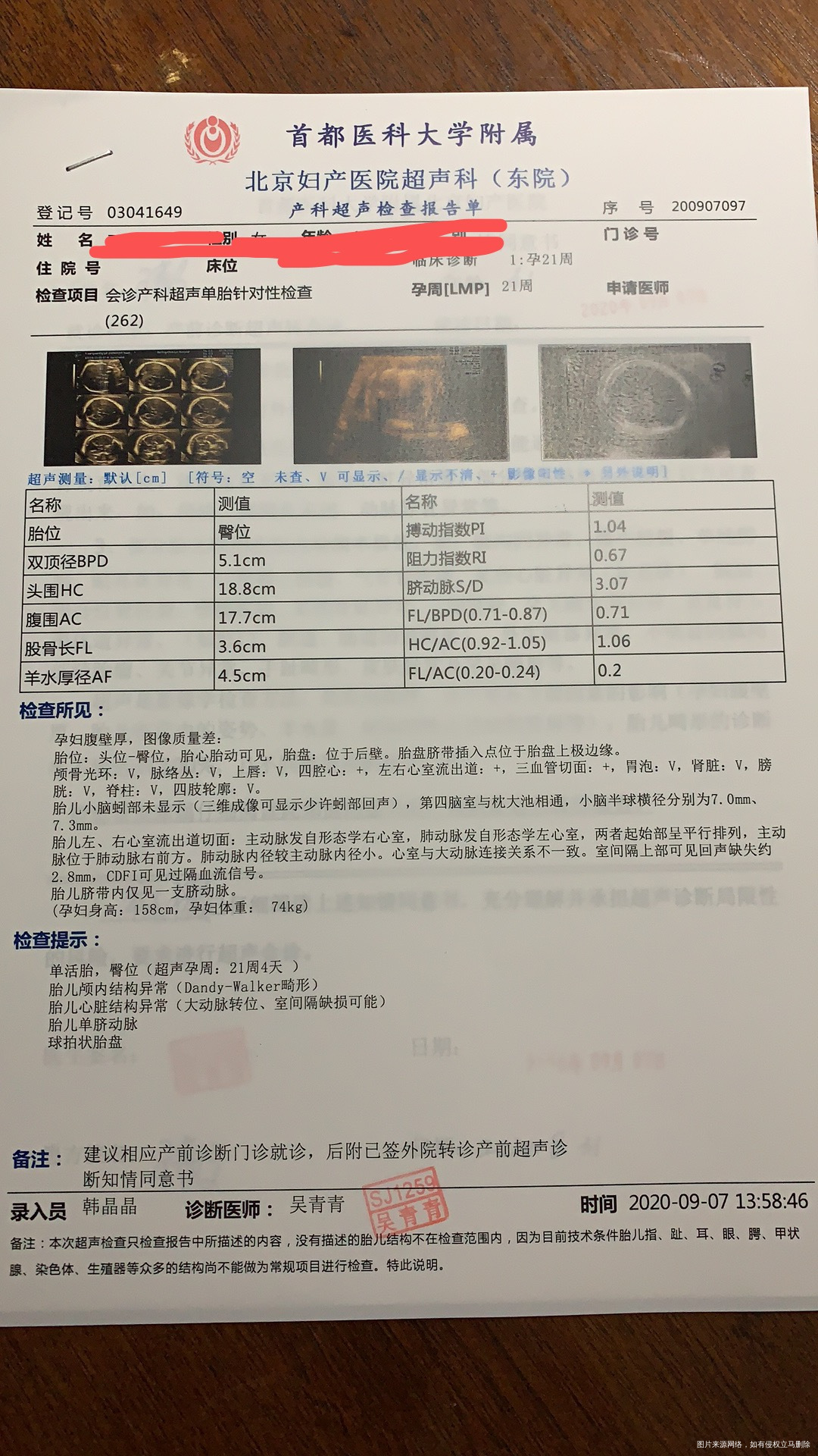 今年4月25日移植两个鲜胚二级一个三级一个两