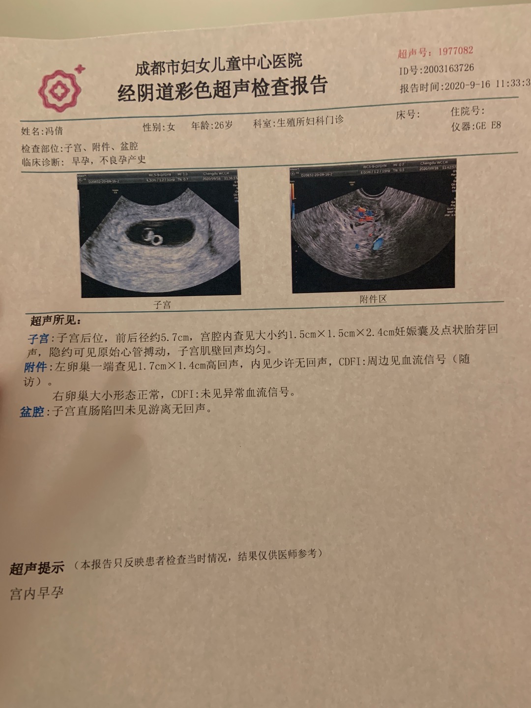 医生末次月经726811排卵的我促排怀孕的今