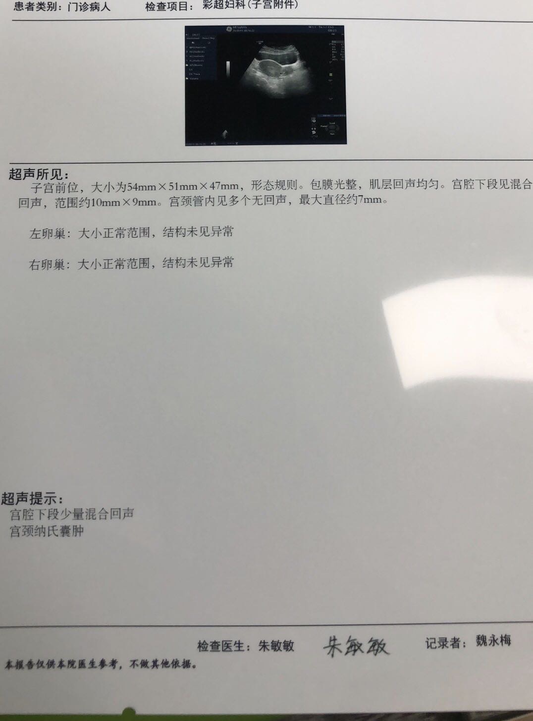胎停自然流产16天目前无出血请问1没掉干净的