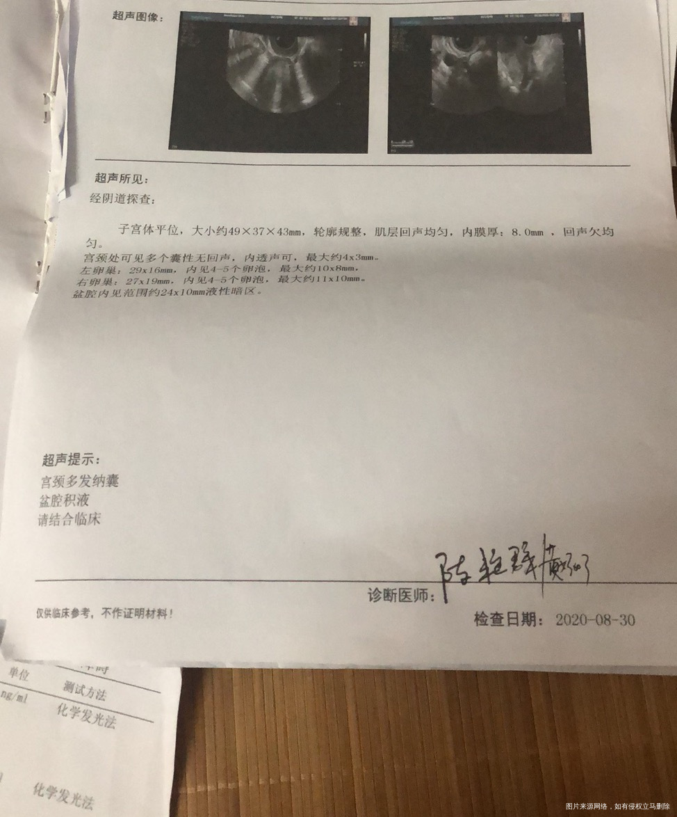 帮忙看看我的卵泡20×14质量好不好