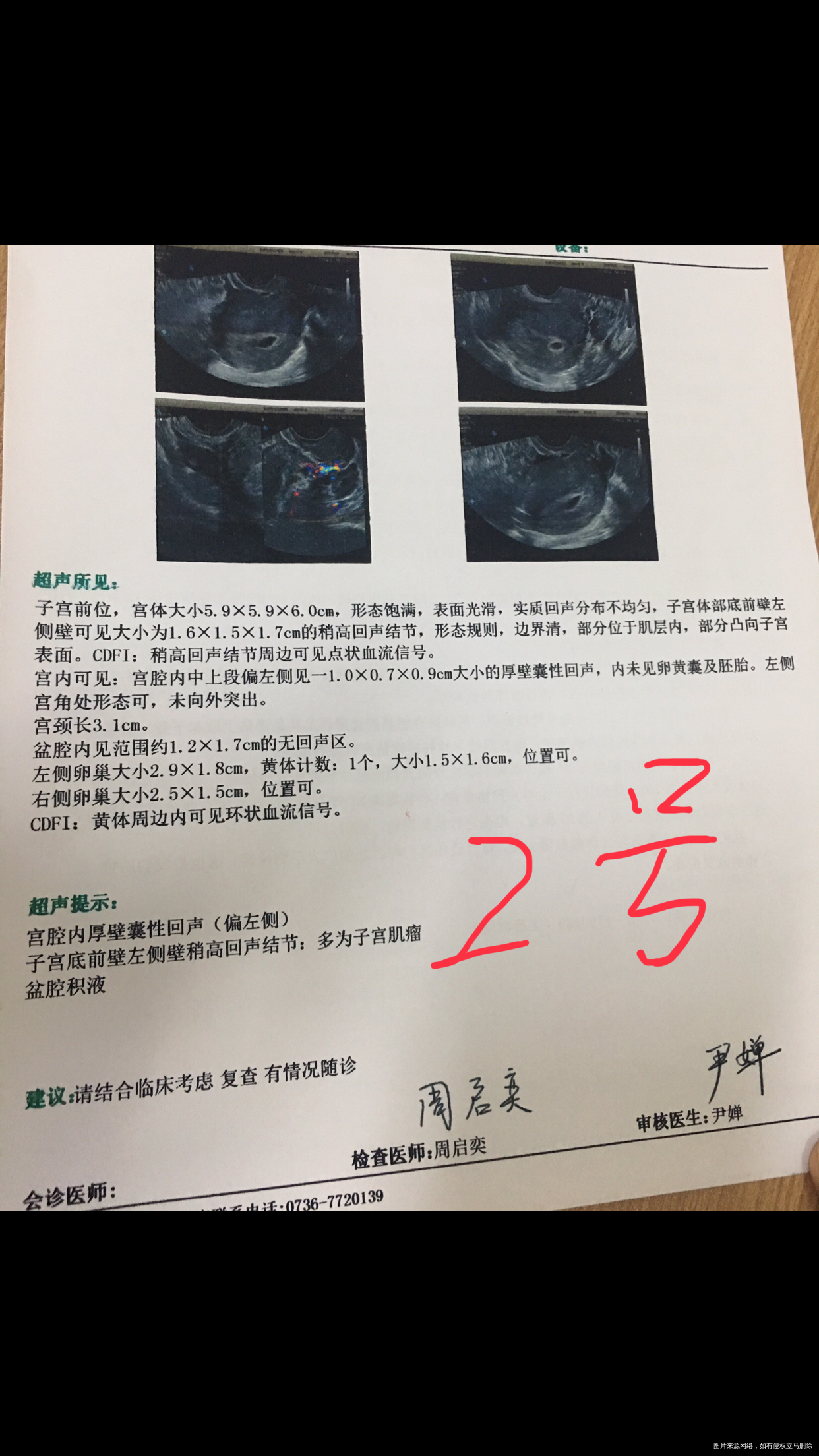 医生您好我8月8号移植两枚五天的4bc囊胚1