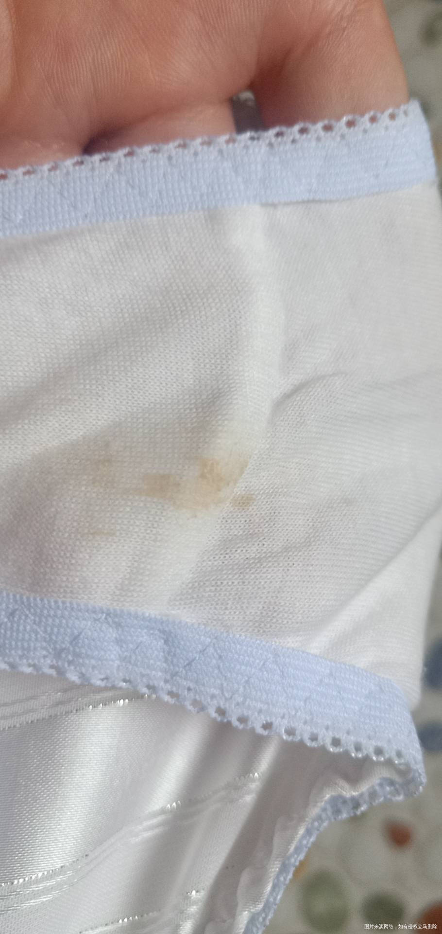 刚怀孕怎么白带是这样的