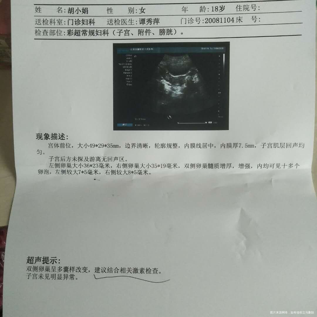 我现在18周岁从一开始来月经就开始不调然后想