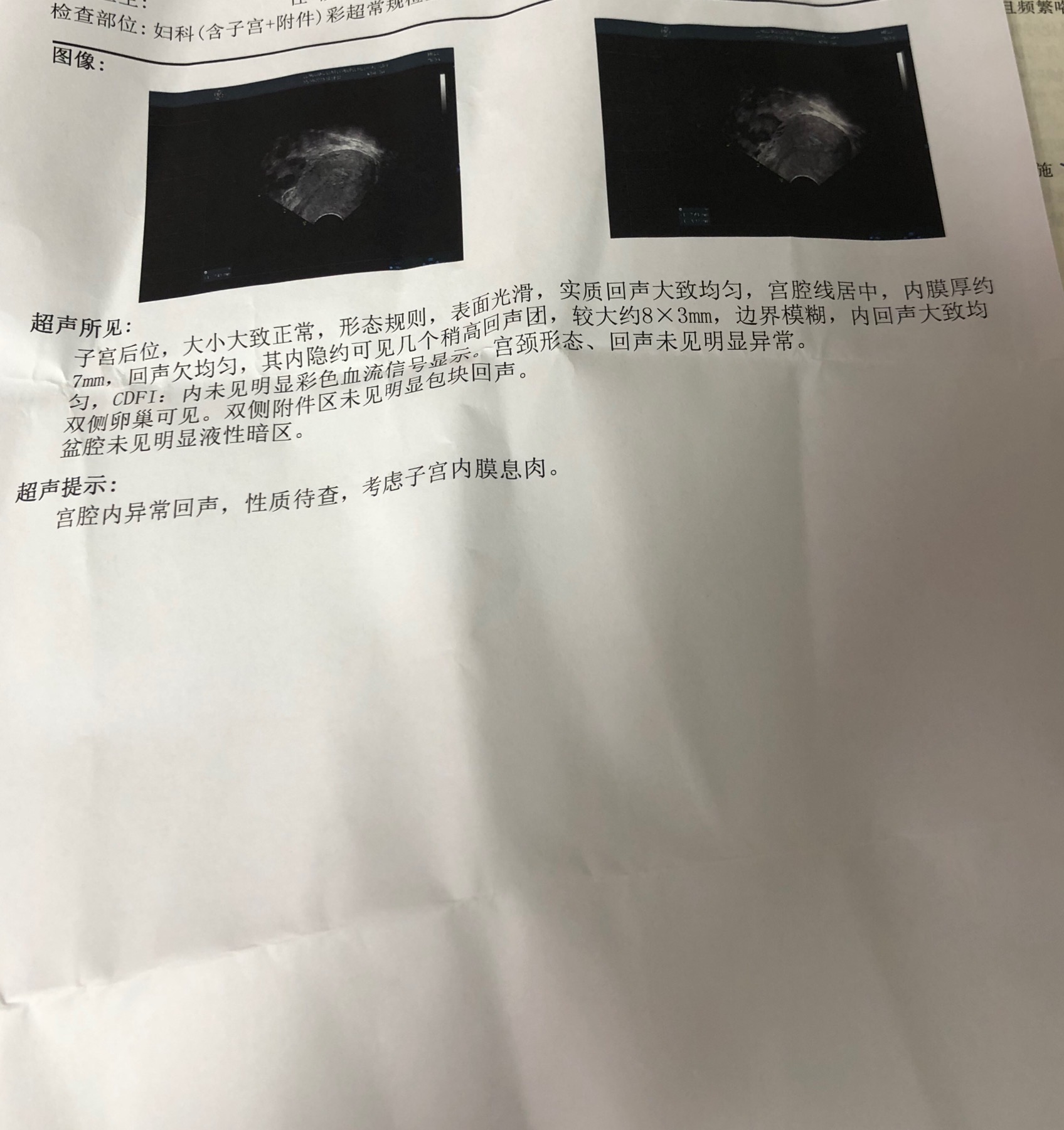 你好这是我月经干净后去做的彩超医生开了地屈孕