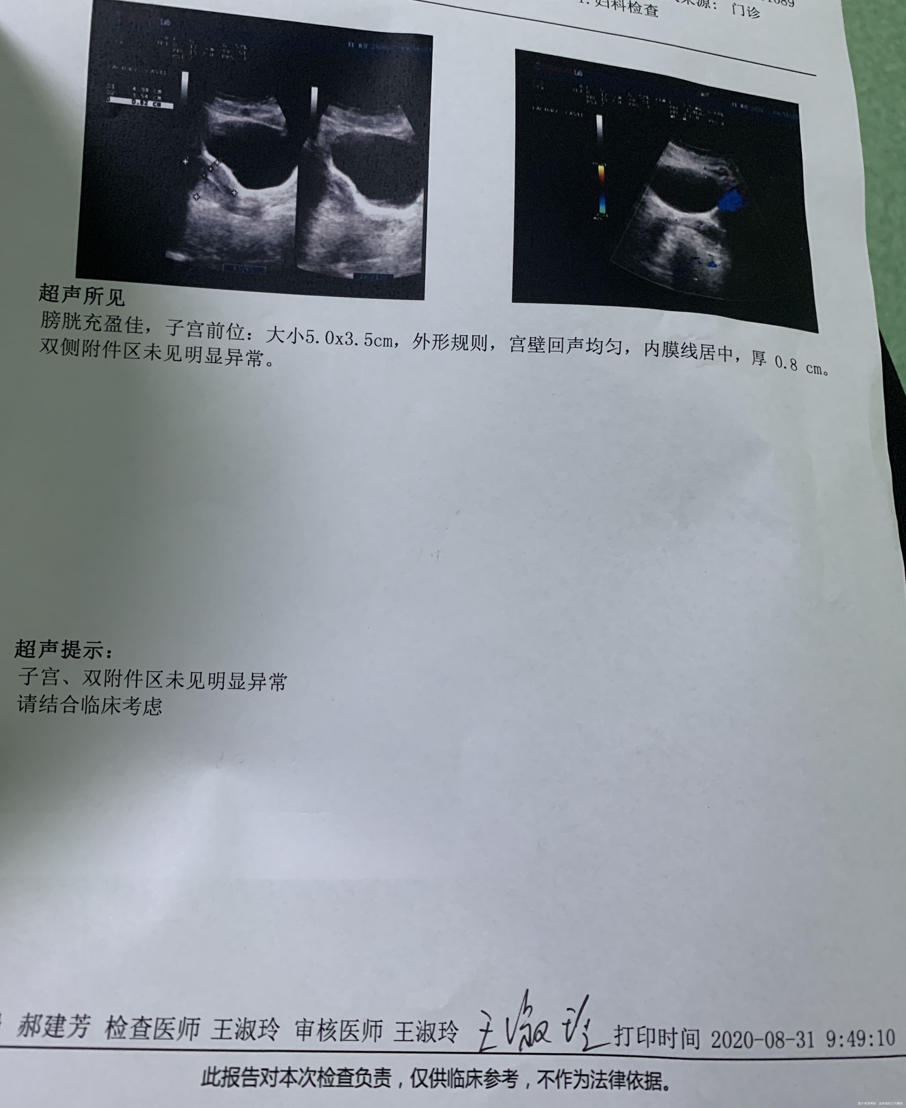 医生我想问一下上次月经是七月14号来的现在还
