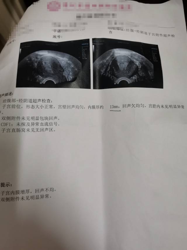 医生你好我是6月底去医生检查B超发现子宫内膜