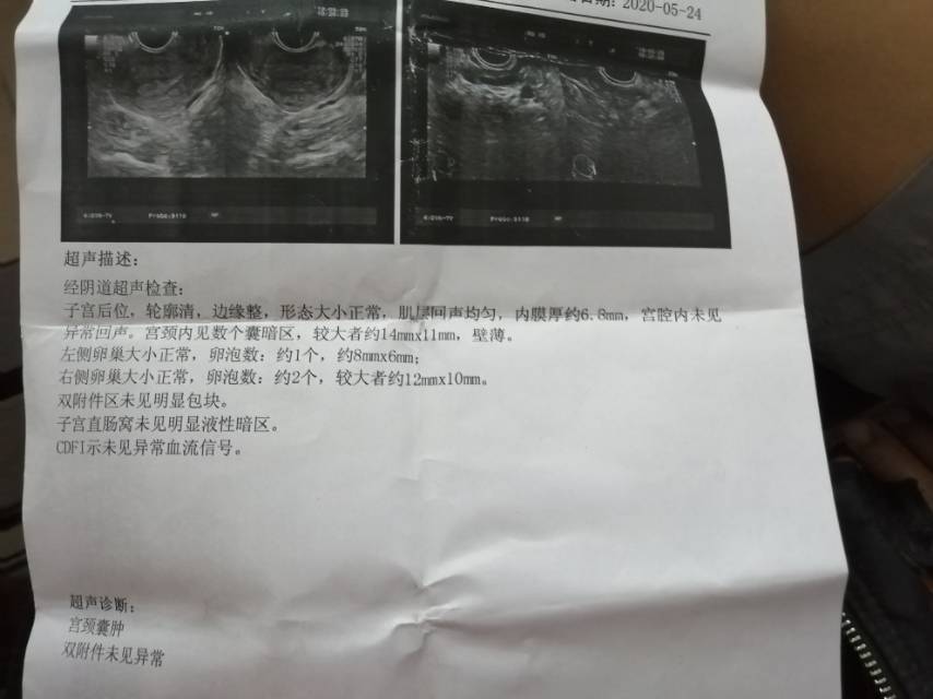 两年前不知道怀孕然后月经期正常但经血黑粘稠第