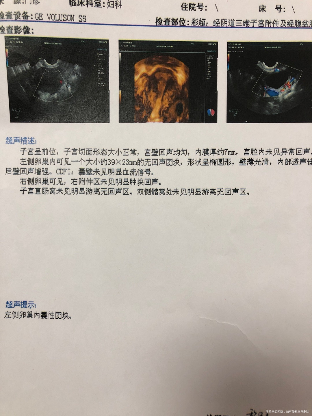 首次怀孕10周胎停未见胎心后来绒毛染色体检测