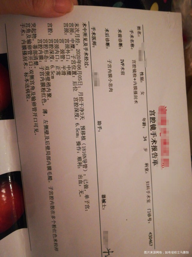 女多囊卵巢综合症男有精子畸形都是原发性不孕不