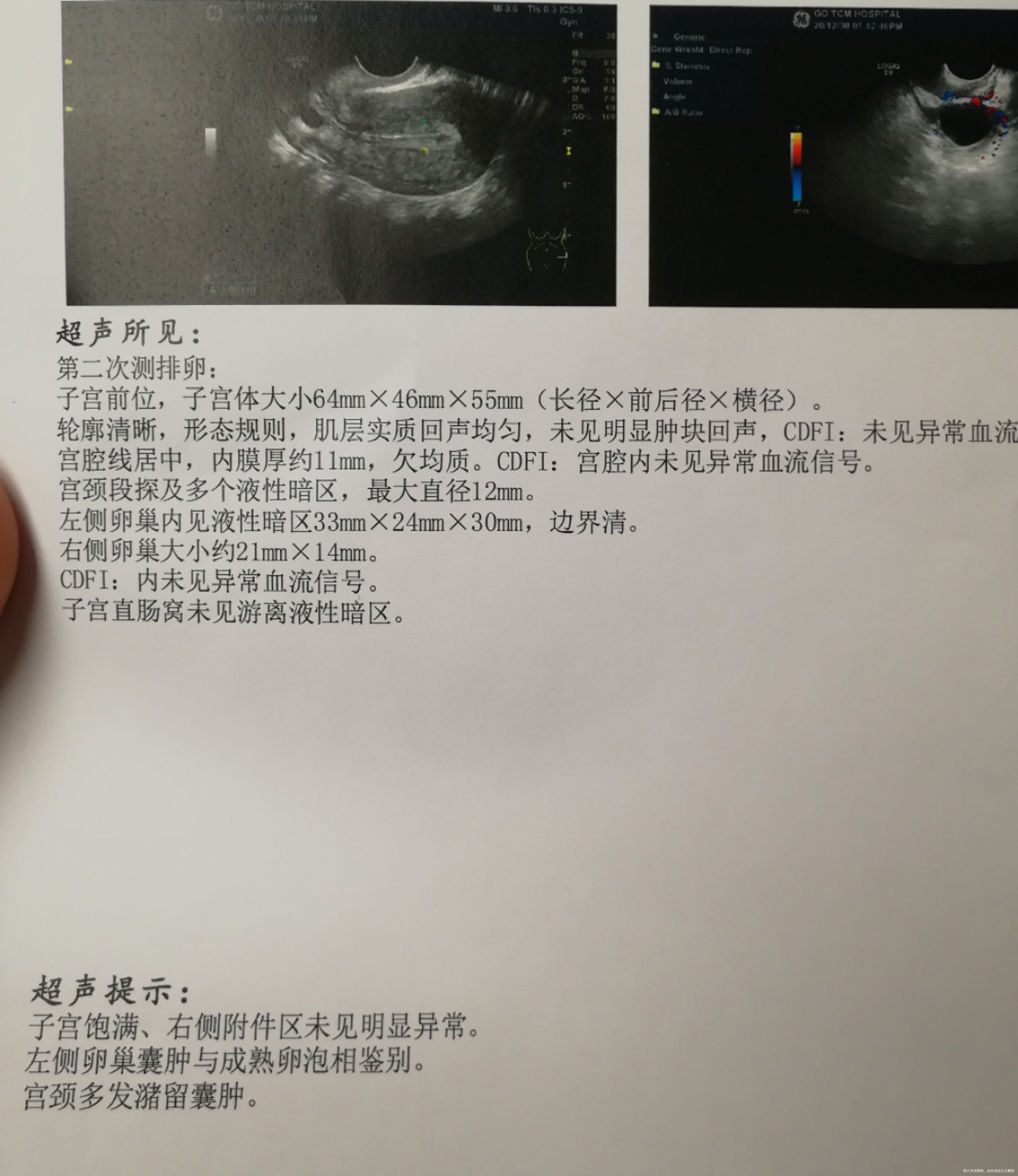 AMH046没希望了吗月经第七天起吃了5天来