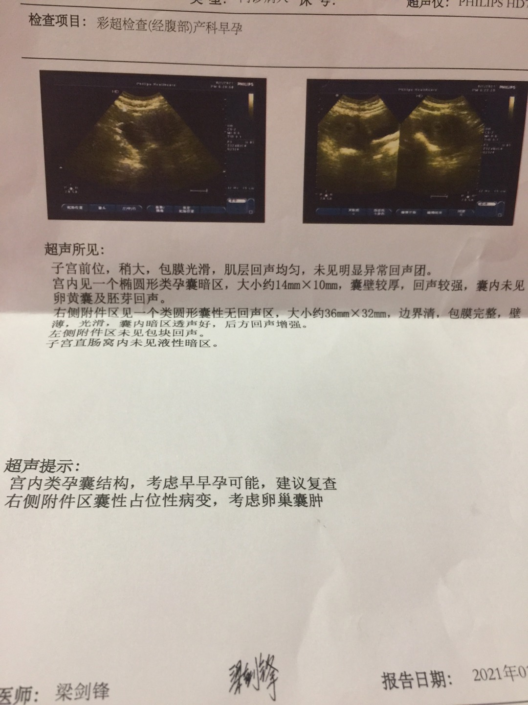 末次月经11月26日12月29测试纸查出双杆