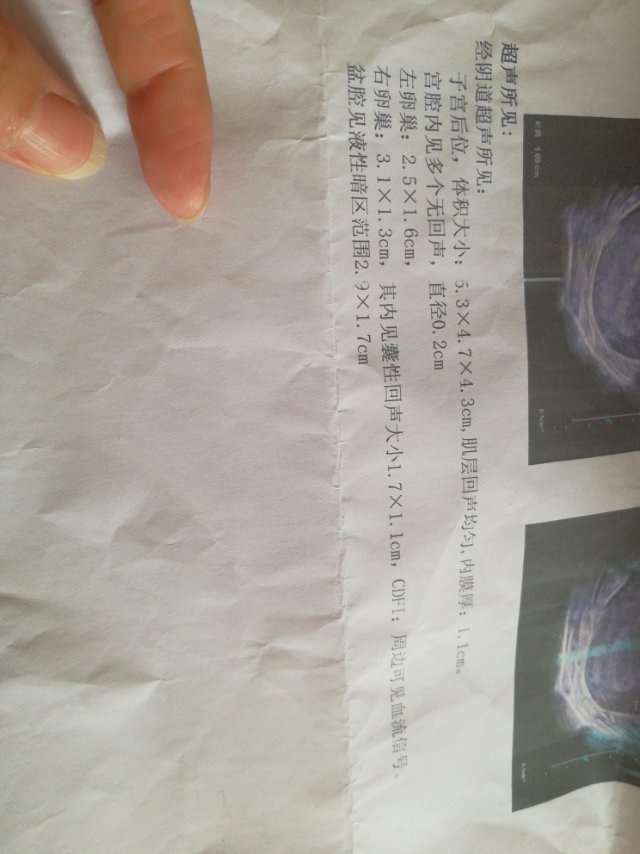 您好我想问一下我近3个月内月经不正常了11月