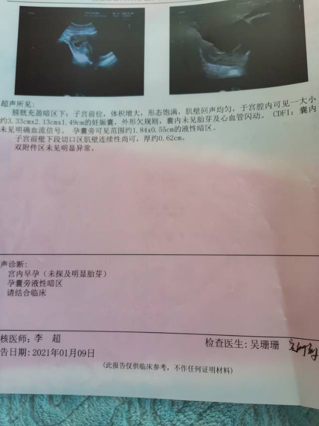 停经83天了五十多天的时候有点褐色分泌物去医