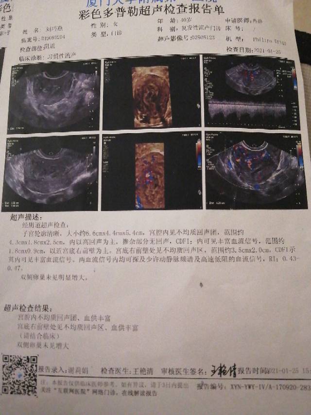 胎停三次都是没胎心停在六周多这次末次月经20