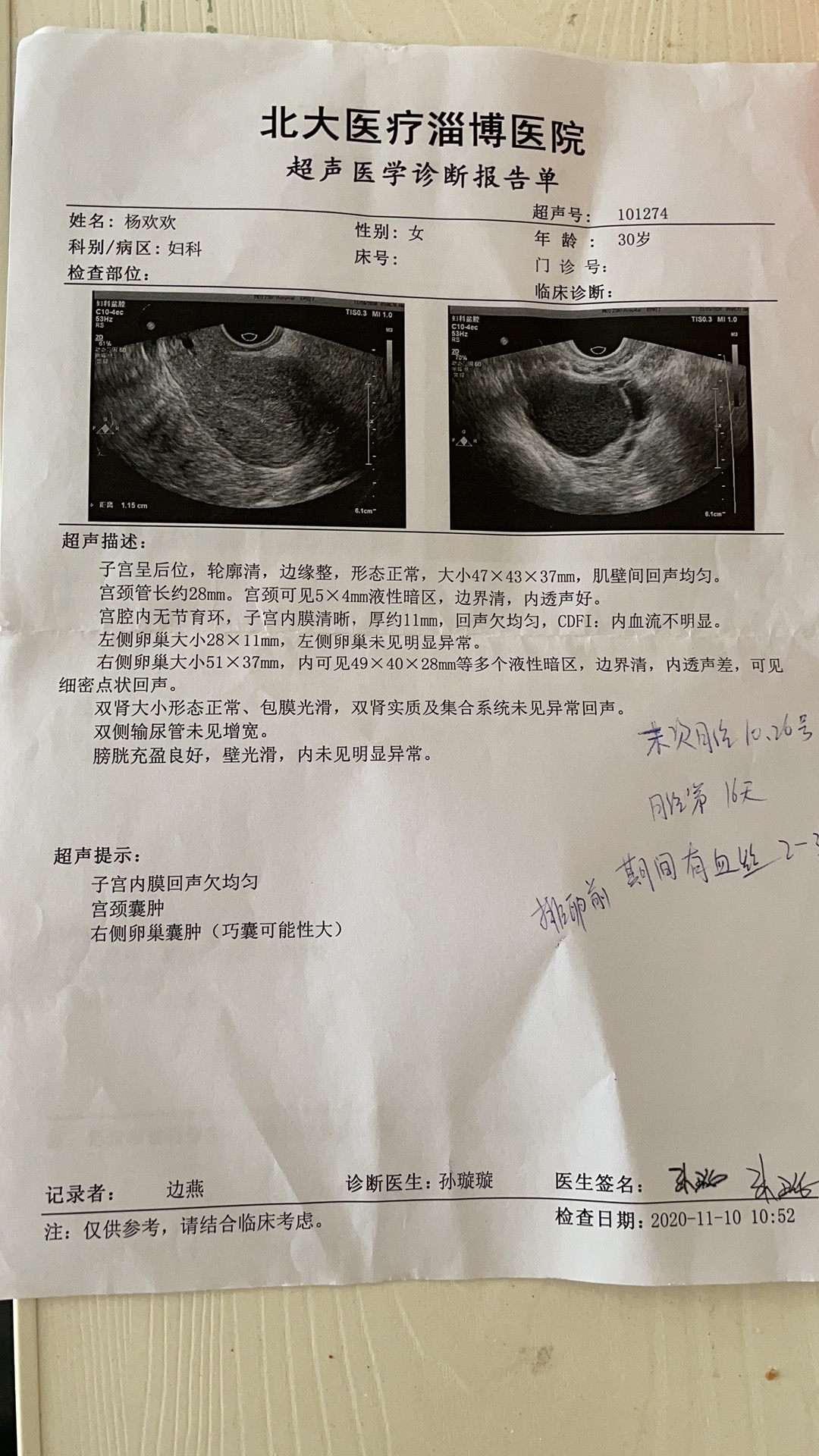 第一次取卵长方案取12配3都移植失败年后打算
